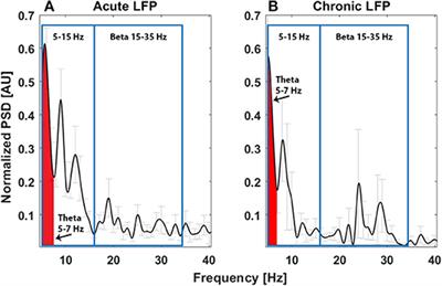 Thalamic Local Field Potentials Are Related to Long-Term DBS Effects in Tourette Syndrome